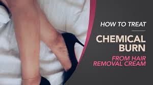 Hair removal creams like nair seemed cool as hell when i first discovered them. How To Treat A Chemical Burn From Hair Removal Cream 2021
