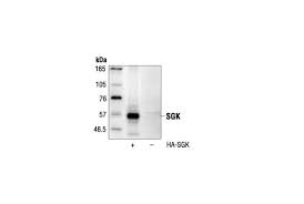 There are many opportunities to participate in a komen event; Sgk Antibody Cell Signaling Technology