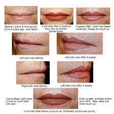 Hellobeautifulface Com Skincare Specialist Permanent Makeup Anti Aging Permanent Makeup Lip Permanent Makeup Lip Liner
