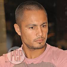 Derek Ramsey injures his knee in frisbee competition