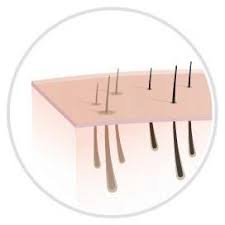 The price goes for $449 on amazon and on tria's beauty tria hair removal laser 4x: Tria Beauty Laser Hair Removal Precision Laser Hair Removal Pink Amazon De Beauty