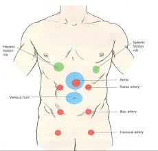 Image result for Venous Hum