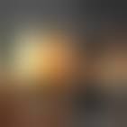 Image result for conjunctival melanoma