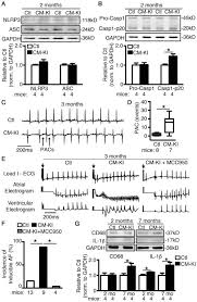 Rancangan pengajaran tahunan tingkatan 5 2021 kurikulum standard sekolah menengah, kongsikan bersama rakan. Enhanced Cardiomyocyte Nlrp3 Inflammasome Signaling Promotes Atrial Fibrillation Abstract Europe Pmc