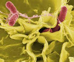 Most types of salmonella cause an illness called salmonellosis, which is the focus of this website. Salmonellosis Wikipedia