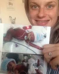 Miracle twins survive being born at 25 weeks