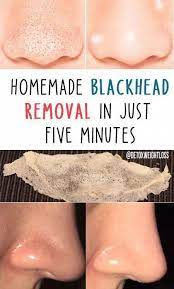 Pin On Easy Way To Remove Warts