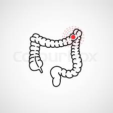 With rectal cancer, diarrhea is quite common. Colon Cancer Vector Logo Icon Stock Vector Colourbox