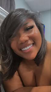 Porcelain Veneers Experience with Dr. Diego Leon in Colombia