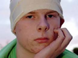 Find bus thugs who nearly killed teen