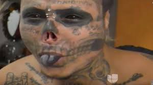 İskelete Benzemek İçin Kulaklarını ve Burnunu Kesti !