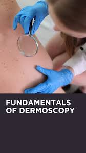 Image result for Dermoscopy