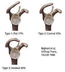 Bigliani classification (types of acromion). Acromion Classifications Shoulderdoc