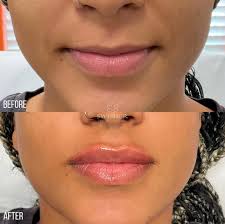 Swisher Skin and Laser Center