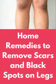 Pin On Beauty Tips Skincare