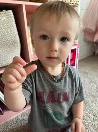 I need opinions. Quick run down Around 2 months old we noticed extremely  dry skin no matter how much lotion, oils, etc we were using. Got out