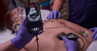 Join the POCUS Revolution: Unlock the ...