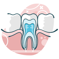 Check spelling or type a new query. Root Canal Kew Kew East Hawthorn Vic Willsmere Dental