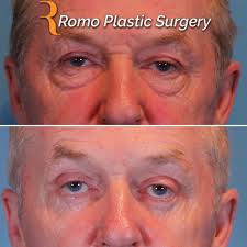 Profile for Romo Plastic Surgery