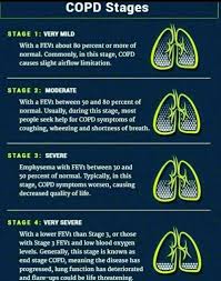 Image result for COPD Staging