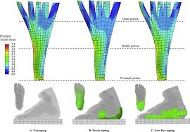 Get superior comfort & revolutionary support. Prediction On The Plantar Fascia Strain Offload Upon Fascia Taping And Low Dye Taping During Running Sciencedirect