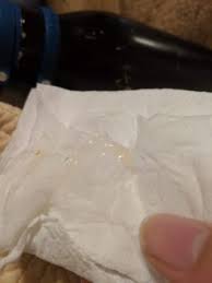 In most cases, loss of mucus plugs can be natural or after a cervical how big is a mucus plug? Mucous Plug Tmi February 2019 Birth Club Babycenter Canada