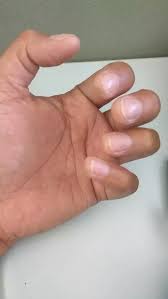 The little finger, or pinky finger, also known as the fifth digit, or pinkie, is the most ulnar and smallest finger of the human hand, opposite the thumb, and next to the ring finger. My Pinky Is A Bit Curved Is It Natural It S Causing Me Trouble On My Guitar Playing Need Help Quora