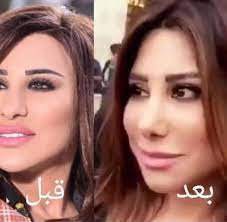 بالصور، كيف تغيّر شكل نجمات ستار أكاديمي الموسم الأوّل بعد 14 عاماً؟ Ù†Ø¬ÙˆÙ‰ ÙƒØ±Ù… ØªØµØ¯Ù… Ø¬Ù…Ù‡ÙˆØ±Ù‡Ø§ Ø¨Ø¹Ø¯ Ø¹Ù…Ù„ÙŠØ© Ø§Ù„ØªØ¬Ù…ÙŠÙ„ Ù…Ø¬Ù„Ø© Ø³ÙŠØ¯ØªÙŠ