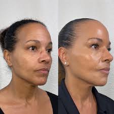 TOP 10 BEST Medical Esthetician near Carmichael, CA 95608