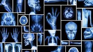 We did not find results for: How Long Does It Take To Be A Radiologist College Learners
