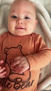 Better late than never 🤣 Highest shunt setting = the least amount of fluid  draining which is a great thing! That means her hydrocephalus is being  managed really well! As far as her head shape I’m not ...