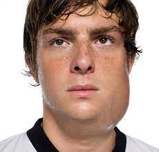 Mumps Die Krankheit Und Der Impfstoff