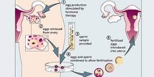 Medical ivf abbreviation meaning defined here. Stages Of Ivf Procedure Biotexcom Center For Human Reproduction