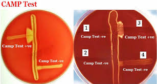 Clostridium perfringens on blood agar. Camp Test And Reverse Camp Test