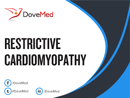 Image result for Restrictive Cardiomyopathy