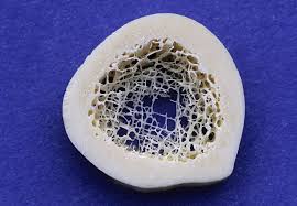 Find the perfect cross section of bone stock illustrations from getty images. Bone Marrow Stimulating Medications Boost Blood Counts