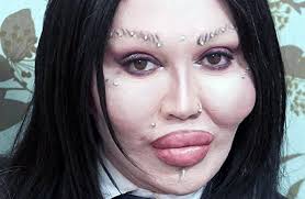 Unlicensed cosmetic surgeon Rafael Casildo was known for his cheap,  unconventional techniques. Here he is performing a butt-lift procedure,  injecting 5 pounds of sausage meat into the rump of his witless client.