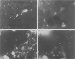 Rossi and cholodny buried slide technique. In Situ Hybridization Of Soil Samples Containing Natural Bacterial Download Scientific Diagram