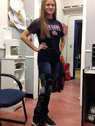 Post Op Knee Brace Knee Brace Outfit Acl Knee Brace Knee Brace