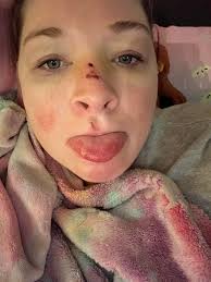 You know those lovely intrusive thoughts about "what if I stabbed through  my hand with the knife I'm cutting carrots with?" or "oh! a high point!  maybe I should jump!" --well, today,