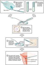 Assisted Reproductive Technology Wikipedia
