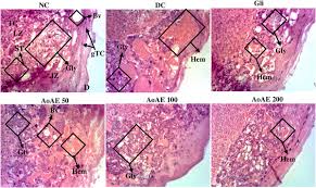 Image result for Angylocalyx