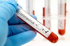Maybe you would like to learn more about one of these? Coronavirus Definisi Penyebaran Hingga Pencegahan