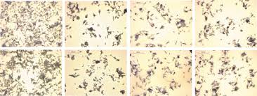 Smith pest control is one of omaha's most affordable solutions to eliminating pests. Https Febs Onlinelibrary Wiley Com Doi Pdf 10 1002 1878 0261 12588