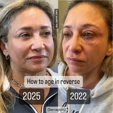 Left: 2025. Right: 2022. 🎉 Aging…but in reverse. This stunning  transformation didn't happen overnight…but it DID happen with consistency,  care, and the right plan. Here's what we focused on: • Multiple rounds