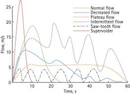 practical uroflowmetry jarvis 2012 bju international