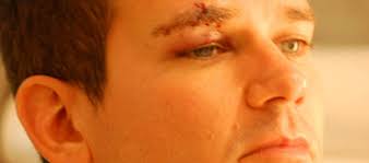 Aggredito perché gay, nel locale gay più famoso del mondo