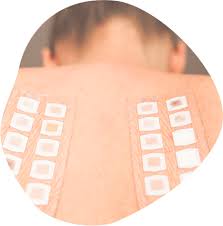 Image result for Patch Testing