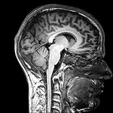 For oral contrast, you will be given a liquid contrast preparation to swallow. How Much Does A Brain Mri Cost From 225