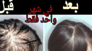 طريقه فك تشابك الشعر بسهولة بدون تقطيع الشعر او اتلافه والتخلص من الهيشان والجفاف بخطوه واحده Youtube